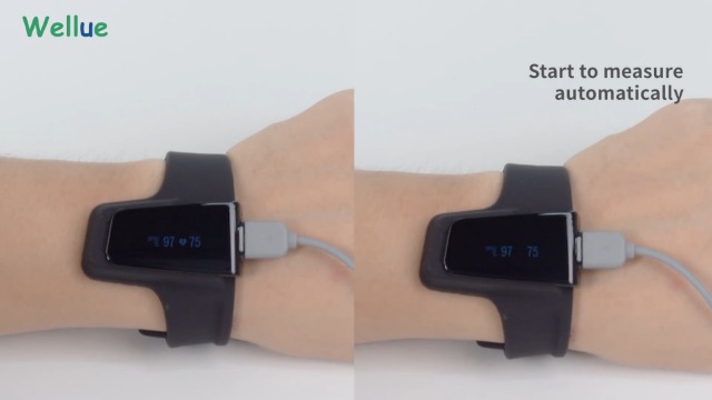 ViATOM Checkme O2 Sleep Pulse Oximeter, Blood Oxygen Monitor
