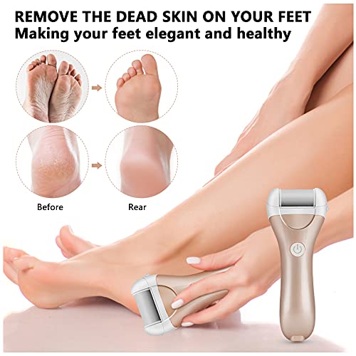 Rappe Electrique Pieds,Hippodance Râpe Electrique Pieds Anti Callosités Pied Rape Pedicure Rechargeable con 2 Vitesses pour Eliminer Les PiedsPeaux Mortes et Callosités – vue 6