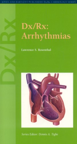Dx/Rx: Arrhythmias: . (Dx/Rx Cardiology Series)