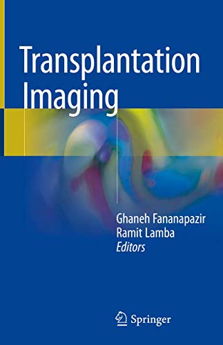 Transplantation Imaging view 2