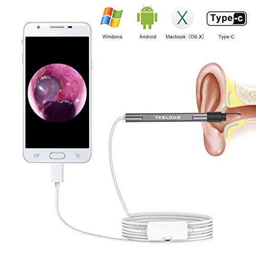Teslong Digital Otoscope with Ear Wax Remover, HD Ear Otoscope Camera with 6