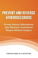 Prevent and Reverse Atherosclerosis : Proven Natural Alternatives That Eliminate Cholesterol Plaque Without Surgery 0999833022 Book Cover