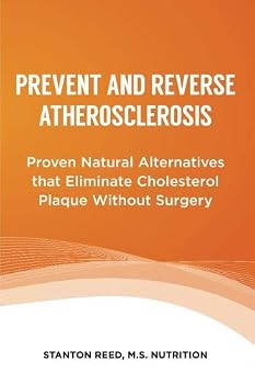 Paperback Prevent and Reverse Atherosclerosis: Proven Natural Alternatives that Eliminate Cholesterol Plaque Without Surgery Book
