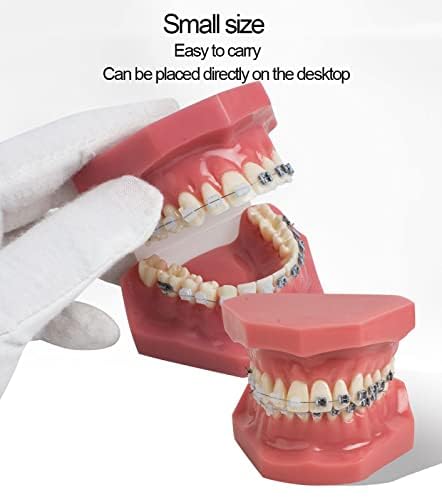 Modelli di Denti per Studenti di Odontoiatria, Modello Dentale Modello Ortodontico con Apparecchi in Ceramica E Metallo, Ottimo per L'insegnamento Scolastico E L'apprendimento degli Studenti, Mate