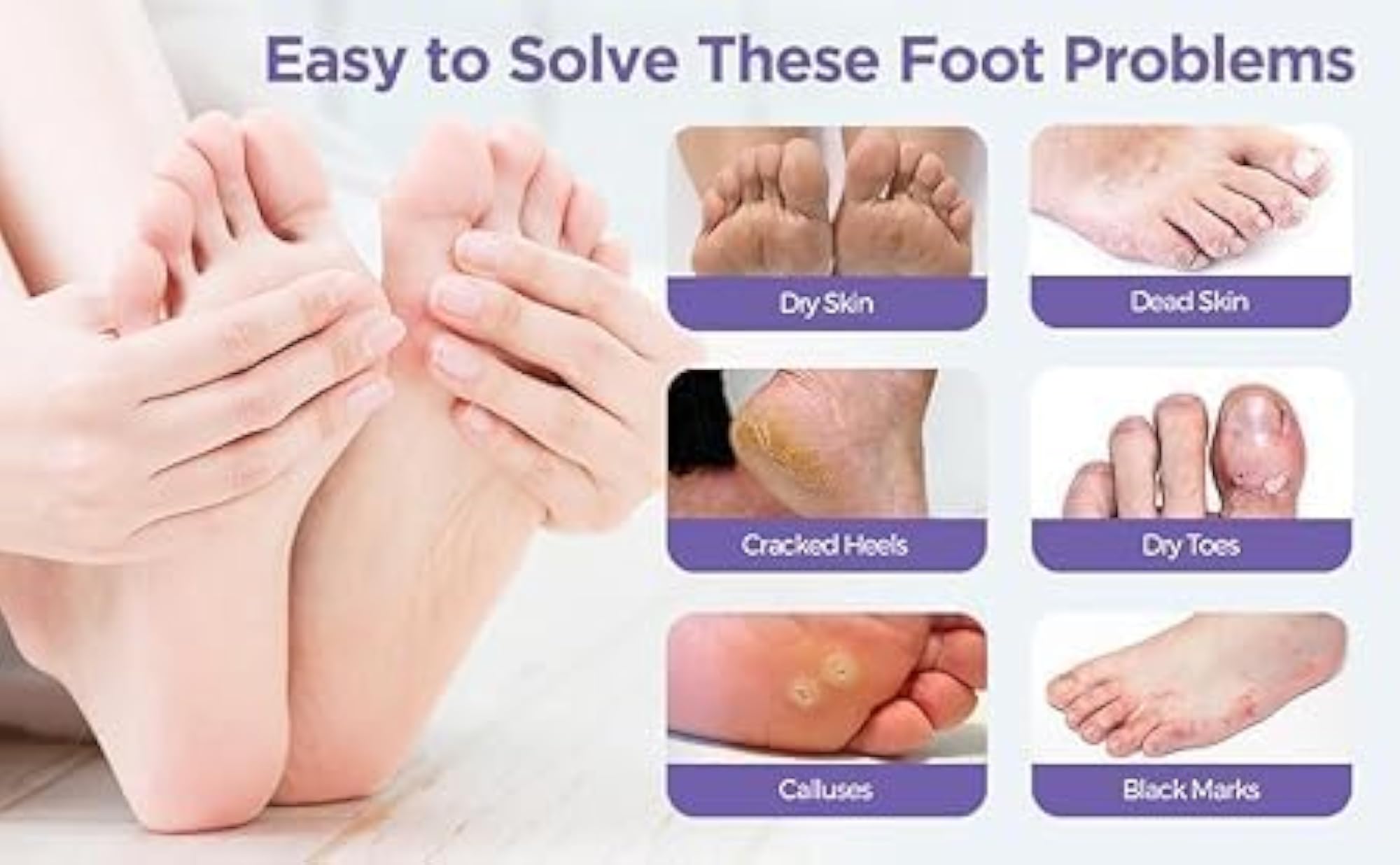 Foot Peeling Mask For Dead Skin Removal, Exfoliating Treatment