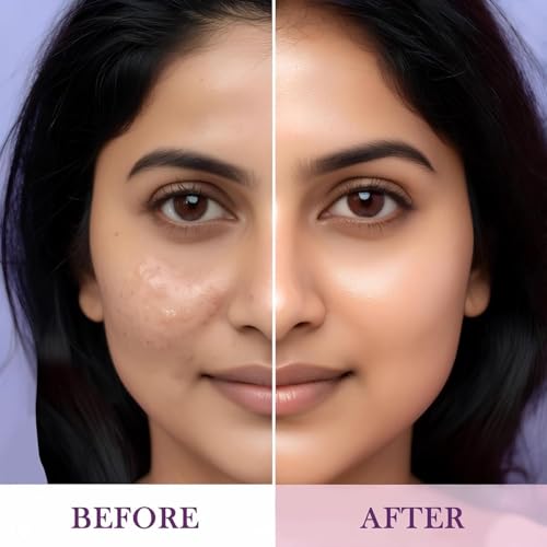 Image of HHudaa Professional Waterproof Oil-Free Longlasting Liquid 24-Hour Colour-True Full Coverage Foundation For All Skins Matte Finish For Women, Girls 30 Ml-1pcs (HHH)
