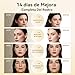 ANLAN Mini Radiofrecuencia Facial Imagen de ANLAN Mini Radiofrecuencia Facial