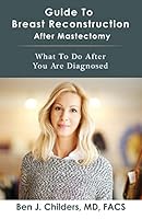 Guide to Breast Reconstruction After Mastectomy: What to Do After You Are Diagnosed 1519243049 Book Cover