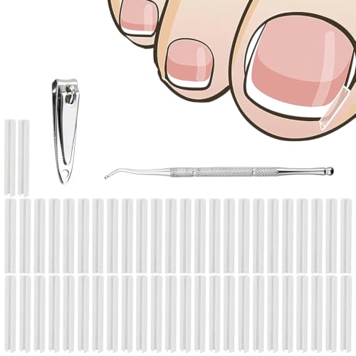 toenail correction tools
