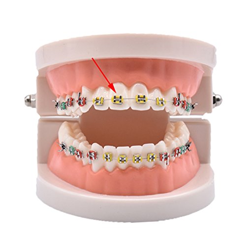 Dental Orthodontic Ligature Ties(1008pcs,Multicolored)