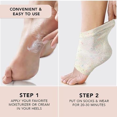 Kitsch Moisturizing Spa Socks - Gel Socks For Cracked Heel Repair | Heel Socks For Dry Cracked Feet | Dry Feet Treatment For Women | Cracked Feet Treatment | Toeless Socks For Women | Foot Care #TOP5