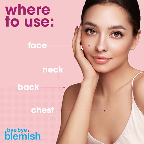 Bye Bye Blemish Acne Drying Lotion, Reduce Pimples Overnight 1oz, 1-Pack