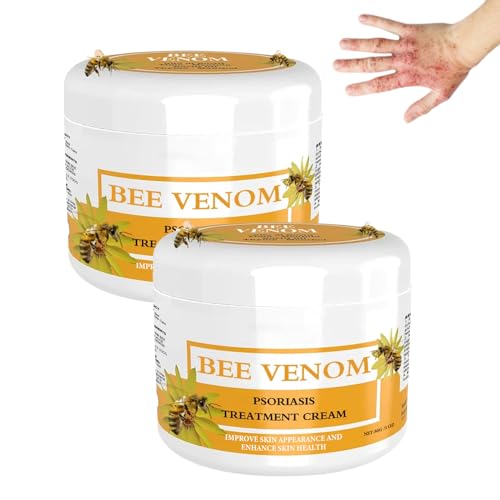 Crema de tratamiento para la psoriasis, veneno de abeja para la psoriasis, veneno de abeja, crema para el tratamiento de la psoriasis, crema de veneno de abeja de Nueva Zelanda, crema de miel, crema
