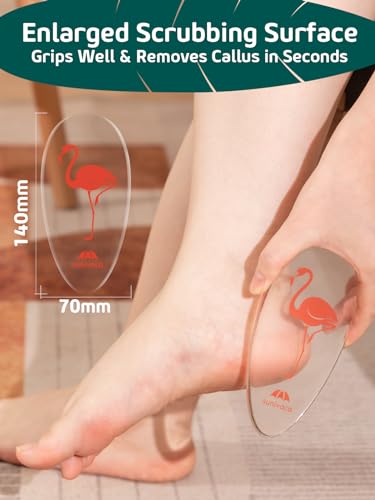 Sunivaca Glass Foot File Callus Remover for Feet, Flamingo Gifts for Women, Feet Scrubber Dead Skin Remover, Professional Pedicure Tools at Home, Heel Scraper for Cracked Heels Heavy Duty — view 4