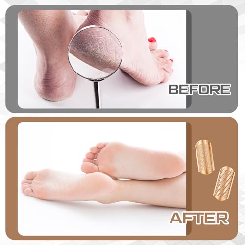 Image of Moxweyeni 8 Pack Rose Gold Foot File Callus Remover Replacement Blades Metal Pedicure Rasp Hard Skin Remove Scrubber Stainless Steel 2 Designs Big /fine Hole for Detachable Foot Grater