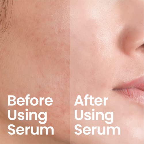 PORTION Hyaluronic Acid Serum: 1.5% Hyaluronic Acid & 1% Polyglutamic Acid - Image 4