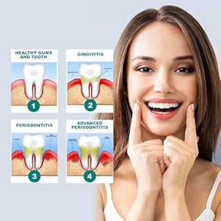 MINGRUO Confezione da 2 gocce per ricrescita e rigenerazione delle gengive