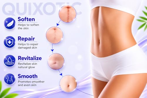 Image of QUIXOTIC Silicone Scar Sheets Tape Roll 1.5M | Reusable Silicone Strips for Scar Care | Surgical, C-Section, Tummy Tuck, Keloid & Acne Scars | Skin-Friendly (A1) (SKIN TONE)
