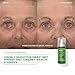 Murad Retinal ReSculpt Overnight Treatment Refill - Advanced Face & Neck Serum with Encapsulated Retinal, Kangaroo Paw, Olive, Oat Smooths Deep Wrinkles & Crepey Skin, Lifts Sagging Skin - 1 Fl Oz