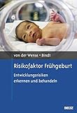 Risikofaktor Frühgeburt: Entwicklungsrisiken erkennen und behandeln (Risikofaktoren der Entwicklung im Kindes- und Jugendalter)