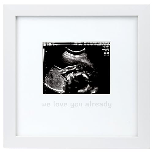 Image of Tiny Ideas We Love You Already Sonogram Sentiment Frame, Baby Announcement, Gender Neutral Ultrasound Keepsake, Ideal Pregnancy Gift, Baby Shower and Nursery Decor, 4”x5” Photo Insert, White