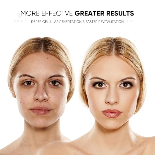 Image of KIMEE LED Face Mask for Men and Women | Photon Therapy Mask with 3 Color Light Modes | Anti-Aging, Acne, Wrinkle Removal | Skin Rejuvenation and Glowing Skin Facial Care at Home(NOT RECHARGABLE)