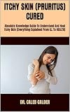 skins for kindle oasis  ITCHY SKIN (PRURITUS) CURED : Absolute Knowledge Guide To Understand And Heal Itchy Skin (Everything Explained From ILL To HEALTH) (English Edition)