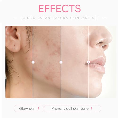 Skin-Care-Hydration-Gifts-Cherry-Blossom-Skincare-8-Piece-Set-for-Women-CleanserTonerEye-CreamEssence-SerumHair-Clip-Hair-Rope-Pink-OctopusVegan-Cruelty-Free-Facial-kit