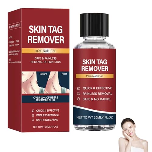 Fast-Acting Skin Tag Removal Kit, 30ML Natural and Gentle Salicylic Acid Formula, Zero Pain Skin Tag Remover, Suitable for Neck, Underarms, Groin, Trusted by The Whole Family (1)