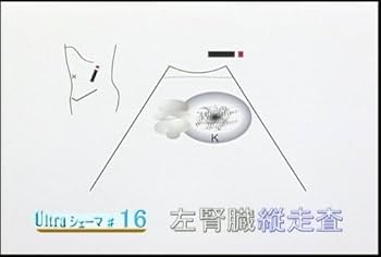 【美品DVD】チャレンジ！超音波走査 下巻 教材・指導用 Amazon.co.jp: チャレンジ! 超音波走査（下巻）ケアネットDVD