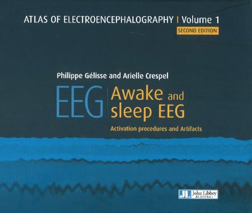 Atlas of Electroencephalography
