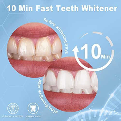 Mysmile Teeth Whitening Kit For Sensitive Teeth With Led Light, 10 Min Non-Sensitive Fast Teeth Whitener, 3 Carbamide Peroxide Teeth Whitening Gel, Enamel Safe #TOP1
