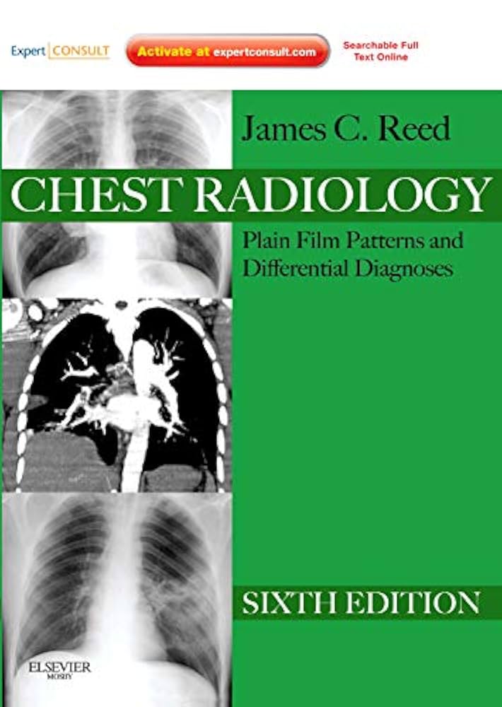 Chest Radiology: Plain Film Patterns and Differential