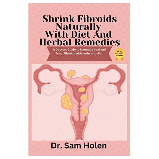 Shrink Fibroids Naturally With Diet & Herbal Remedies: A Doctors Guide to naturally heal Treat herbs diet. Proven Methods To Eliminate, Prevent leiomyoma Miracle cure myoma treatment remedy cookbook