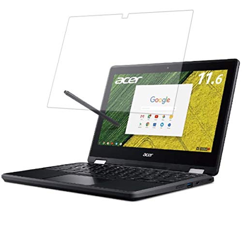 ClearView Acer Chromebook Spin 11 R751TN-N14N 2017�N8�����f�� 11.6�C���`�Ή��y���S��5��@�\���Ռ��z���E�u���[���C�g�J�b�g�z�t���ی�t�B���� ���˖h�~�E�R�ہE�C�A���X