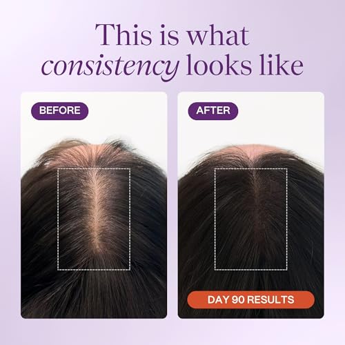 KeraLush Hair Vitamins for Women | Supports Healthy Thick Hair & Volume, Strong Roots, Scalp Care | Biotin, Patented Keratin, Ashwagandha, Vitamin B5, Protects from Pollutants | 30 Servings - Image 5