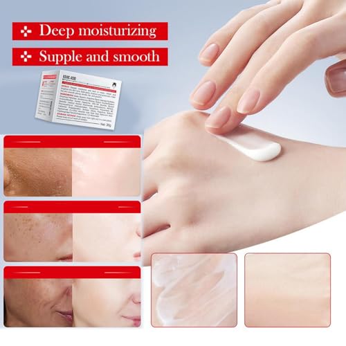 Generic Kojic Acid Cream, Face and Body Gel, Dark Spots, Melasma, Natural Ingredients, Moisturizing and Mild Effect (1pcs acido kojico)