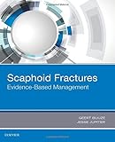 Scaphoid Fractures: Evidence-Based Management