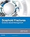 Scaphoid Fractures: Evidence-Based Management