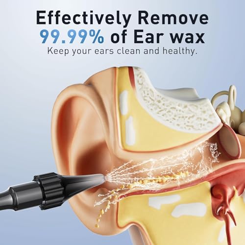 Ear Wax Removal - Electric Ear Irrigation Flushing System with 4 Pressure Modes, Ear Cleaner with Camera, 1080P Otoscope, Ear Cleaning Tool with 7 Pcs Ear Set, Safe and Effective Earwax Removal Kit - Image 4
