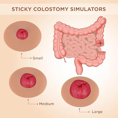 Sticky Colostomy Simulators, Stoma Training Model Set, Multi-Skin Tone Ostomy Care Practice Models for Medical Training and Patient Education- Tan