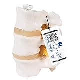 3B Scientific A76/8 Lumbar Vertebrae on Flexible Shaft, Three Vertebrae, 4.3