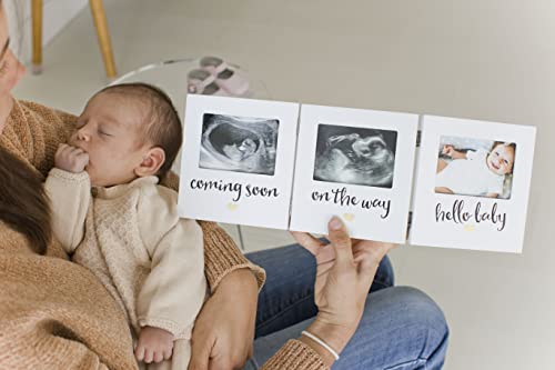 Pearhead Triple Sonogram Keepsake Photo Frame, Baby Ultrasound Tabletop Picture Frame, Gender-Neutral Baby Nursery Décor, Pregnancy To Newborn Photo Frame, White #TOP3
