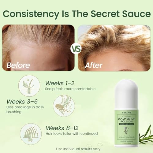 ZZILME Rosemary Hair Growth Serum Roll-On with Caffeine 1.6oz — view 5
