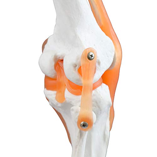 Image of B10212 Knee Joint Model, 4.5 inch Height, 4.5 inch Wide, 11 inch Length