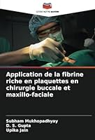 Application de la fibrine riche en plaquettes en chirurgie buccale et maxillo-faciale (French Edition) 3330969040 Book Cover