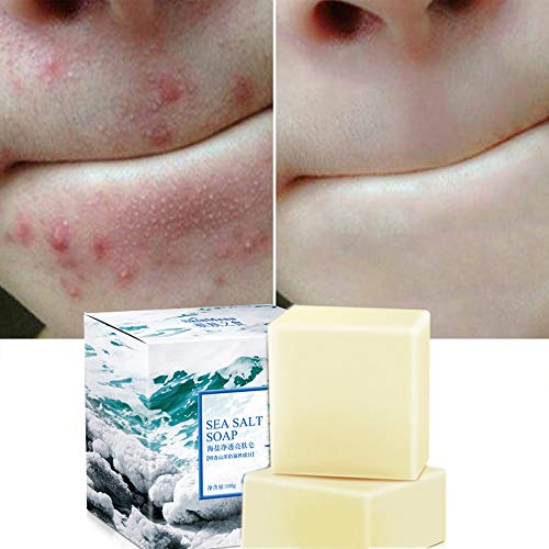 Soap with Sea Salt Natural Goat's Milk for Face Dry and Natural Oily Skin, Remove Acne Anti-cellulite Soap (2PCS)