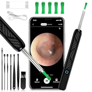 Otoscope Oreille Nettoyeur Caméra HD 1080P