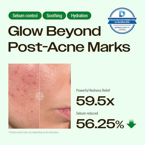 Image of YUMU Cica Exosome Zinc Blemish Relief Cream, Face Moisturizer for Sensitive, Acne-Prone Skin, Lightweight, Breakouts, Barrier Repair, Hydration, Soothing, Oil-Free, Korean Skincare (80 ml /2.70 fl.oz.)