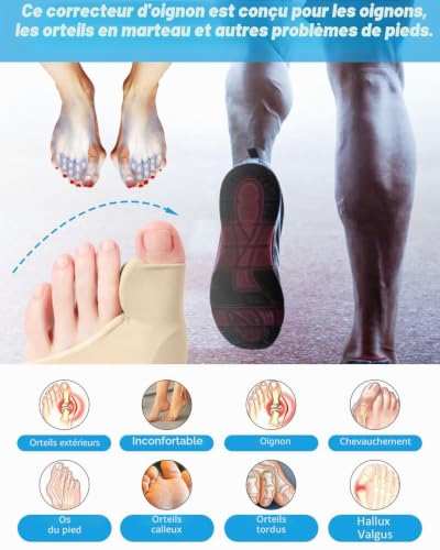 MYGLOAR Chaussettes pour oignons, correction des oignons, chaussettes pour oignons avec protection en gel, bandage pour hommes et femmes, protection des orteils (35-40S, couleur peau) – vue 5